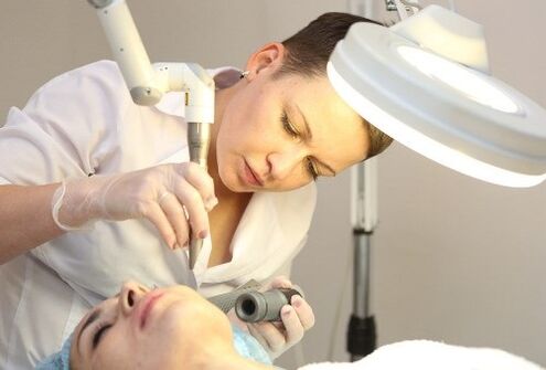 removal of human papillomavirus with laser