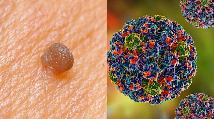 HPV transmission routes