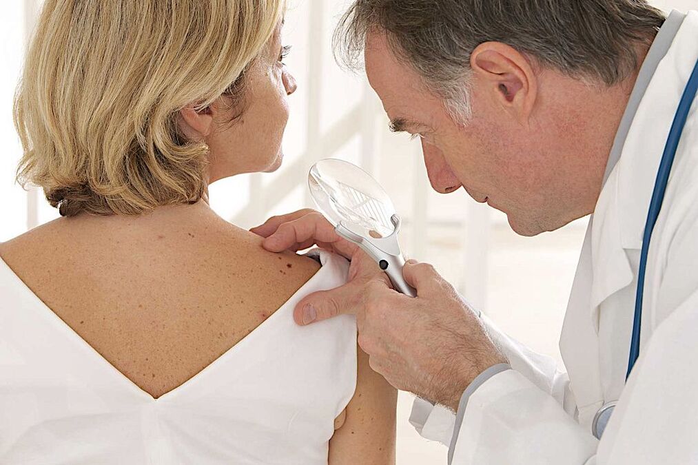 human papillomavirus diagnosis